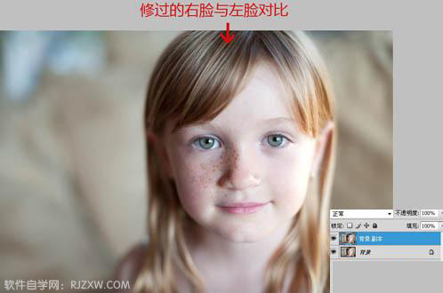 用PS修补工具消除人物脸上的斑点