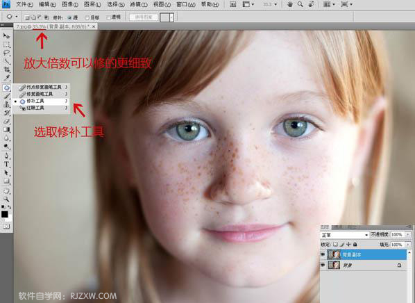用PS修补工具消除人物脸上的斑点