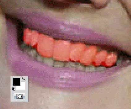 用photoshop美白牙齿教程