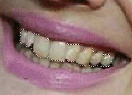 用photoshop美白牙齿教程